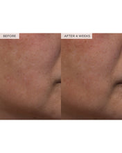 Load image into Gallery viewer, Watermelon Glow PHA+BHA Pore-Tight Toner